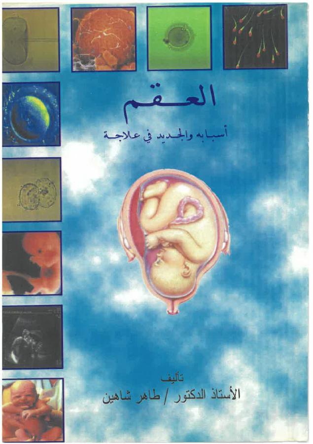 غلاف كتاب العقم أسبابه والجديد في علاجه